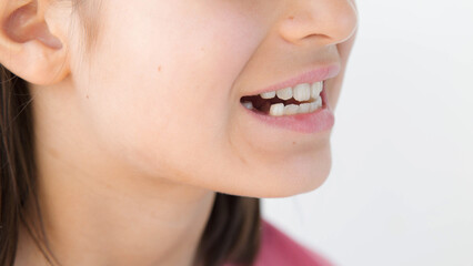 Fototapeta premium Closeup smiling young woman showing missing front tooth with healthy gums, natural skin, positive facial expression, dental care, orthodontic treatment, oral health, childhood dentistry concept
