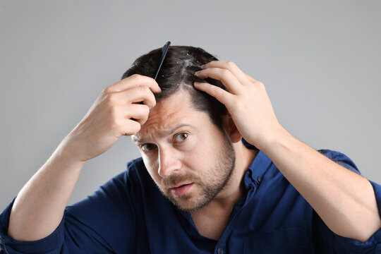 Dandruff problem. Man combing his hair on grey background