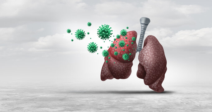 Walking pneumonia outbreak concept showing the spread of Mycoplasma pneumoniae as a contagious respiratory infection affecting the lungs and highlighting public health concerns over seasonal disease t
