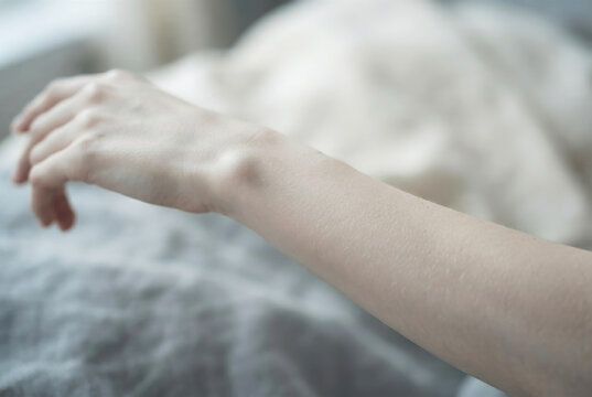 Close up of a bump ganglion cyst on a woman wrist joint in soft bedroom light