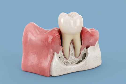 Detailed Anatomical Model of Human Tooth Embedded in Gum and Jawbone for Dental Education and Oral Health Demonstration