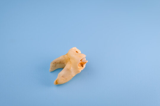 A real extracted primary molar from a child is positioned with its branching roots prominently visible while the damaged crown faces sideways on a blue background for pediatric tooth extraction