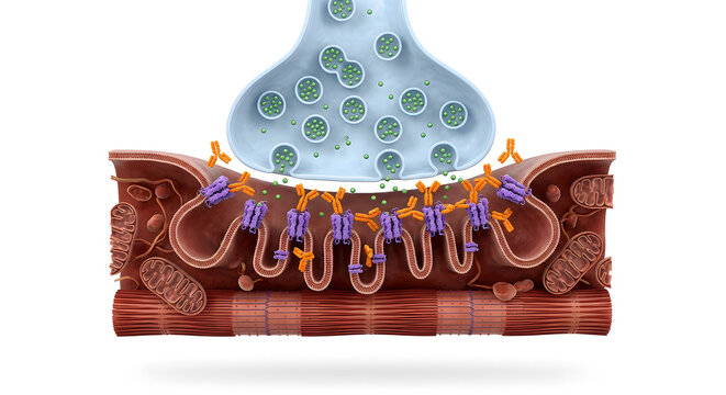 3D Render of Myasthenia Gravis: Antibodies Blocking Acetylcholine Receptors at the Neuromuscular Junction