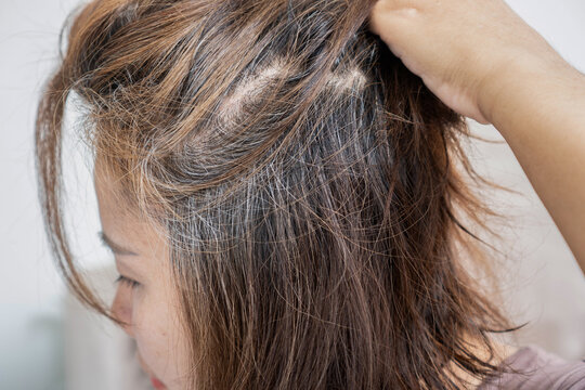 Close-up of a woman lifting her hair to reveal gray roots and scalp issues. Perfect for hair care, aging, hair loss treatment, anti-graying shampoo, and beauty salon concepts
