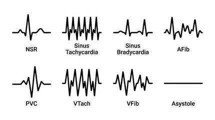 Obraz premium ECG heart rhythm types vector set, medical EKG wave diagrams for NSR AFib and Tachycardia, cardiology diagnostic heartbeat icons for healthcare education