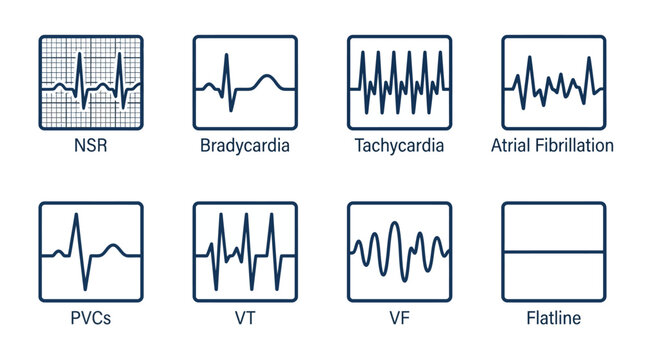 ECG heart rhythm icon set with 8 medical vector elements, electrocardiogram wave diagrams for NSR, bradycardia, tachycardia, and flatline monitoring