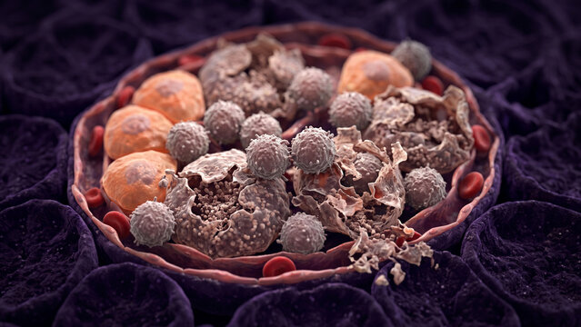 3D medical illustration of sperm development (spermatogenesis) in the seminiferous tubules of the testis