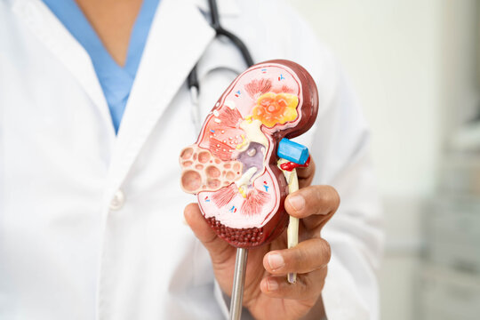 Chronic kidney disease, doctor with model for treatment urinary system, urology, Estimated glomerular filtration rate eGFR.