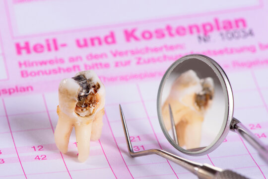 Auf einem Heil- und Kostenplan liegt ein extrahierter Backenzahn mit Karies und Amalgamf&uuml;llung