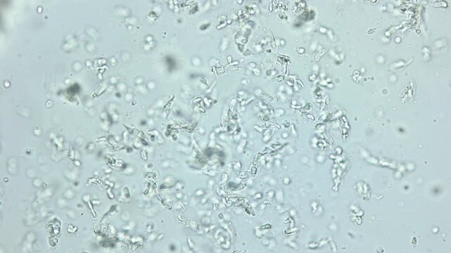 Ciliophoras Licnophora sp. under microscope, class Spirotrichea. Found on the body of the mollusk genus Onchidoris. White sea