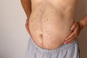 Naklejka premium Overweight Male Belly with Bloating and Abdominal Obesity Concep