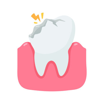 Vivid illustration of a cracked tooth experiencing sharp pain and decay, depicting common oral health problems.