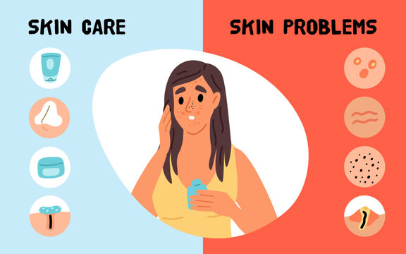 Infographic on acne prevention. Woman with problem skin. Sad girl with blackheads, pimples and enlarged pores. Skincare procedure. Cosmetic routine. Dermatology treatment vector banner