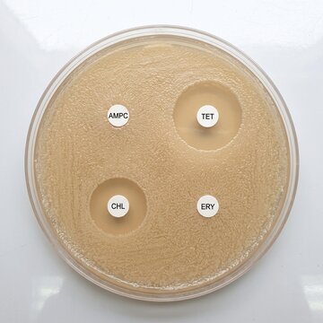 Antimicrobial Resistance: Agar Culture Plate With Antibiotic Discs And Uneven Inhibition Zones