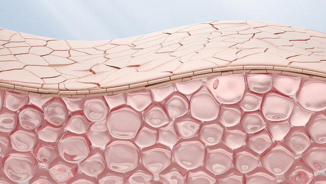 human skin cell layers cracking and breaking down under ultraviolet UV light attack. Visualization of sun damage, skin barrier destruction, and premature aging concept, 3D illustration.