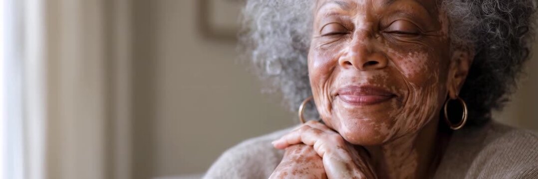 Senior African American woman with vitiligo smiling at home, website banner with copy space for text