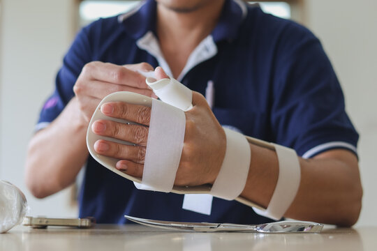 Medical professional custom thermoplastic wrist splint on a patient's arm for hand rehabilitation in a clinic, orthopedic and occupational therapy treatment concept.