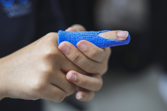 Therapist making asissistive device for immobilize patient finger from rheumatoid arthritis. Splint service for hand injury rehabilitation of occupational therapy clinic.