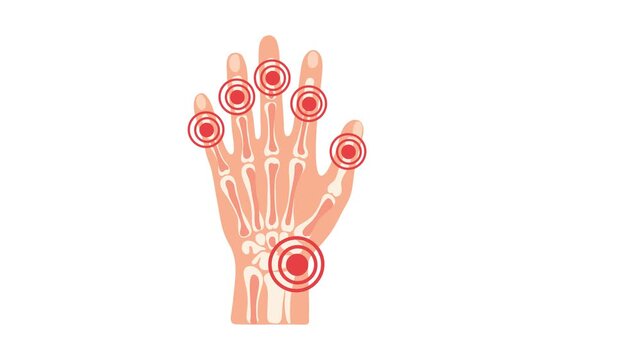 animation hand pain and inflamed joints concept