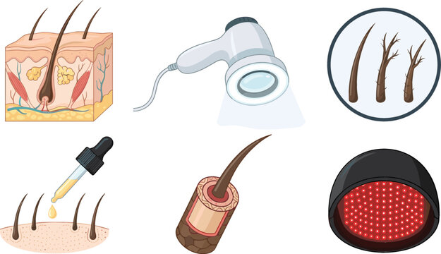 Hair Loss Treatment and Trichology Science Icons Set Featuring Skin Cross Section, Trichoscope Camera, Split Ends, Dropper Oil Serum, Follicle Anatomy, and Laser Therapy Cap Vector Illustration