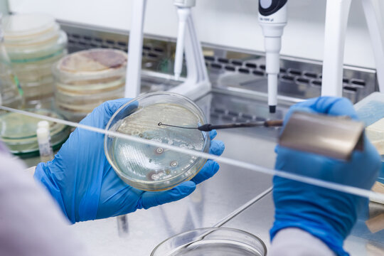 A scientist uses a microbiological loop to contact bacterial colonies on a petri dish in a laboratory.