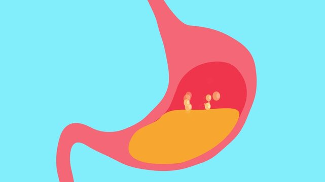 A 2D animation of a stomach with bubbles. Background for an advertisement for gastric bloating treatment. Food poisoning. Sorbents in the stomach.