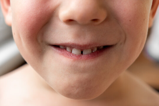 Child's smile. Child's teeth. Baby white teeth of a white-skinned person. Two permanent lower teeth. Even white teeth of a 5-year-old child.