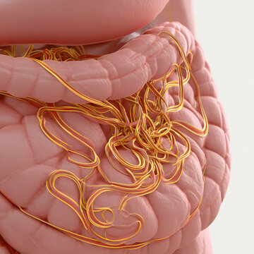 Stomach with Gastroparesis (Nerves): A detailed illustration of the stomach, with a visible depiction of damaged or sluggish vagus nerves intertwined with the stomach wall, symbolizing delayed emptyin