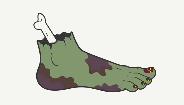 Frightening halloween vector illustration of a severed green zombie foot with purple decay spots and a bone sticking out.