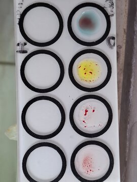 Top view of a blood typing test kit slide showing agglutination reactions in circular wells for ABO and Rh blood group identification in laboratory.