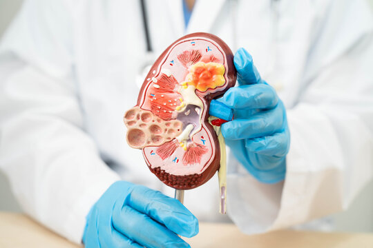 Chronic kidney disease, doctor with model for treatment urinary system, urology, Estimated glomerular filtration rate eGFR.