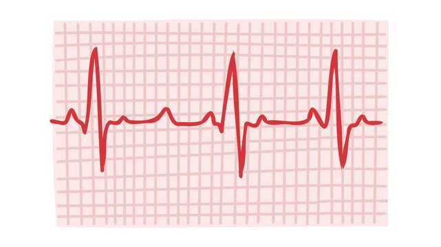 animation of electrocardiogram heartbeat waveform