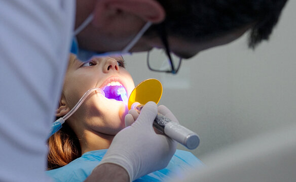 Pediatric dentist using UV curing light lamp on tooth filling for young girl