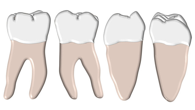 Mandibular first molar