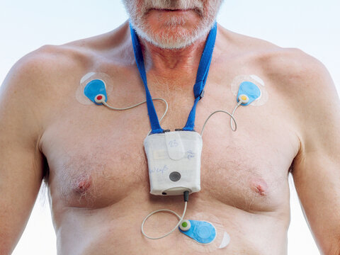 Senior man with long-term ECG on his chest, close up