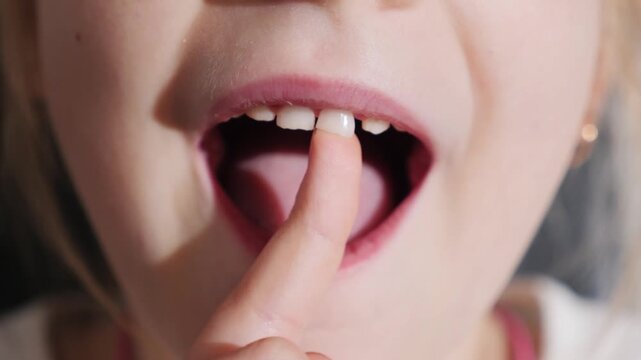 Little girl showing loose milk tooth with her finger close up shot of child open mouth wobbling first baby tooth change process dental health and childhood growth cinematic footage of oral hygiene.