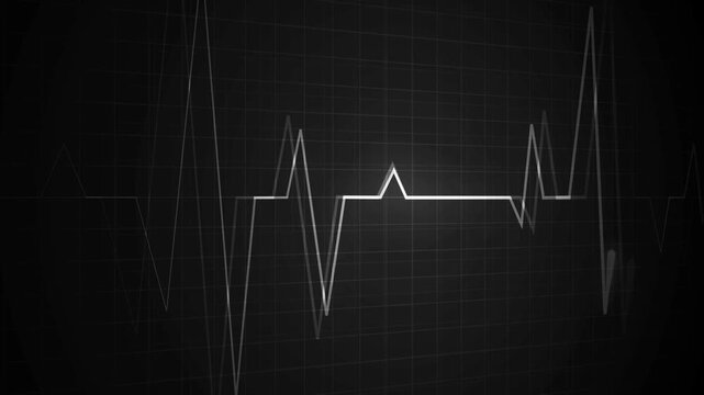 Heartbeat line on a grid pulse pattern for health medicine and emergency monitoring animation