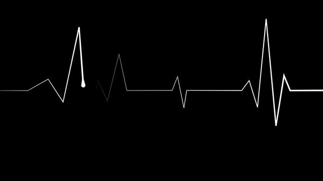 Heartbeat lines electrocardiogram style pulse with sharp spikes and flat sections animation
