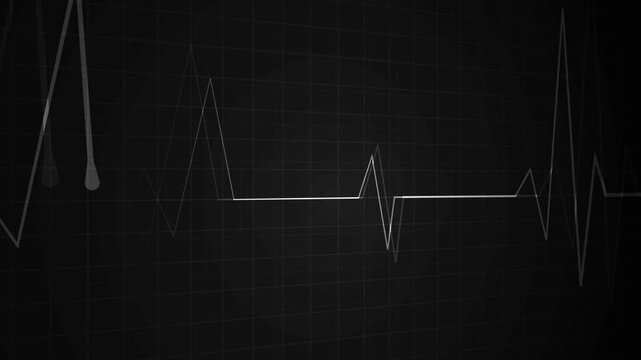 Glowing heartbeat line grid background medical pulse graph with a dramatic spike animation