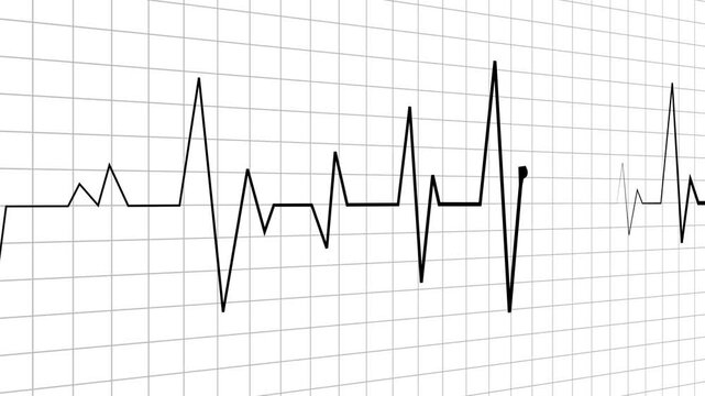 Heartbeat line electrocardiogram pulse pattern medical and health concept animation