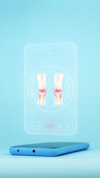 Doctor using a mobile app on his smartphone for knee bone diagnosis. Innovative technology for the early detection of osteoarthritis and patellar fractures. Light blue background.
