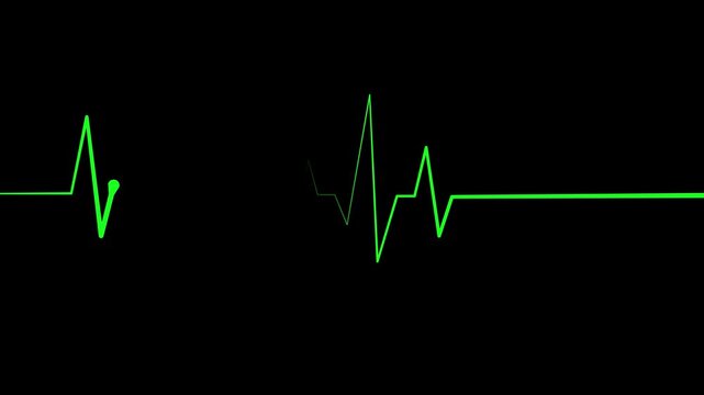Heartbeat line pulse spike and flat line medical concept for heart health monitoring and emergency care animation