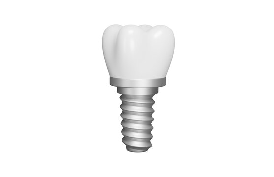 Dental implant 3d icon. Tooth replacement, implant dentistry and oral healthcare concept. Isolated 3D object.