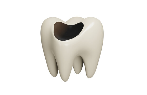 Decayed tooth 3d icon. Dental caries, tooth decay and oral healthcare concept. Isolated 3D object.