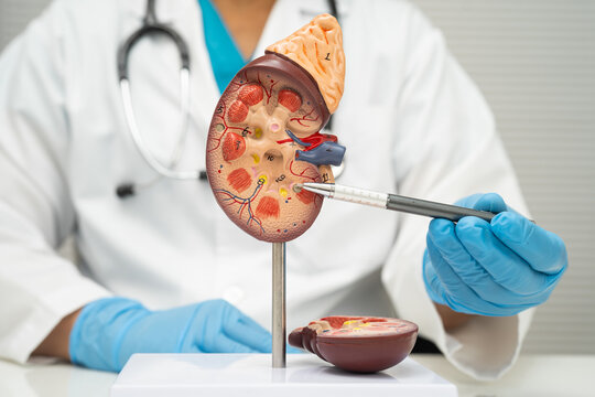Chronic kidney disease, doctor with model for treatment urinary system, urology, Estimated glomerular filtration rate eGFR.