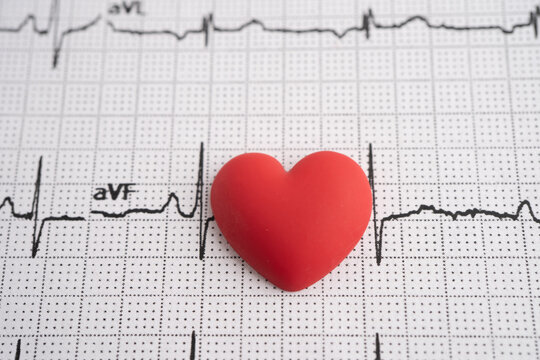 Electrocardiogram ECG, heart wave, heart attack, cardiogram report.