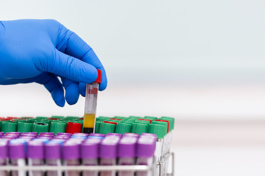 Doctor hand holding blood test tube on white background for laboratory analysis.Sicientist wear blue gloved hands holding blood sample at clinic laboratory.Laboratory exam glucose and scientist.