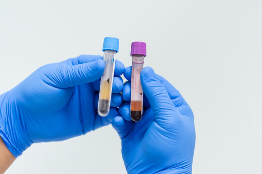Close up scientist hand wear blue gloves holding blood test tubes copy space workplace isolated on white background.Laboratory equipment and medical treatment concept
