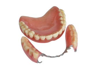 A complete removable denture for the upper jaw and a partial denture for the lower jaw, consisting of artificial teeth and a base made of acrylic plastic that imitates gums. © Михаил Жигалин