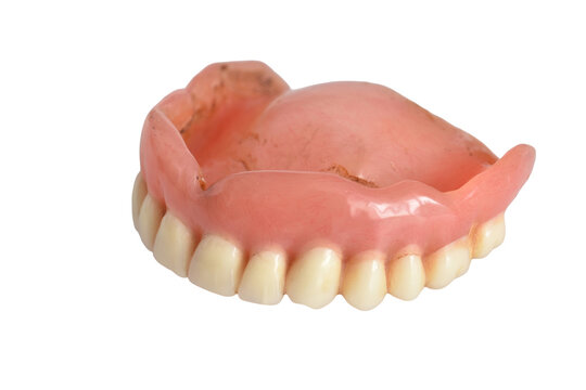 A complete removable denture for the upper jaw, consisting of artificial teeth and an acrylic plastic base that imitates gums.